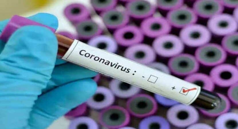 covid19:notestsforasymptomaticintelangana