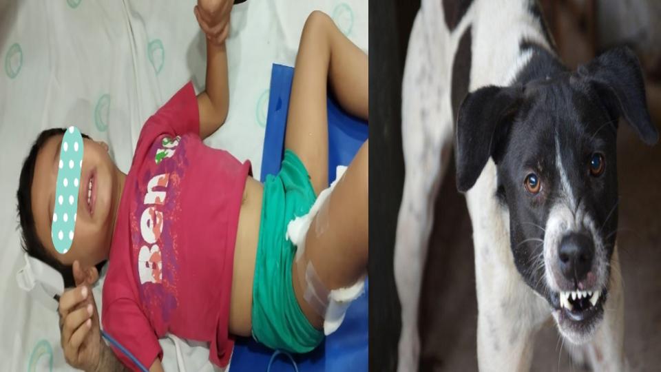 stray-dog-attacks-4-yr-old-boy-in-mehdipatnam-hyderabad