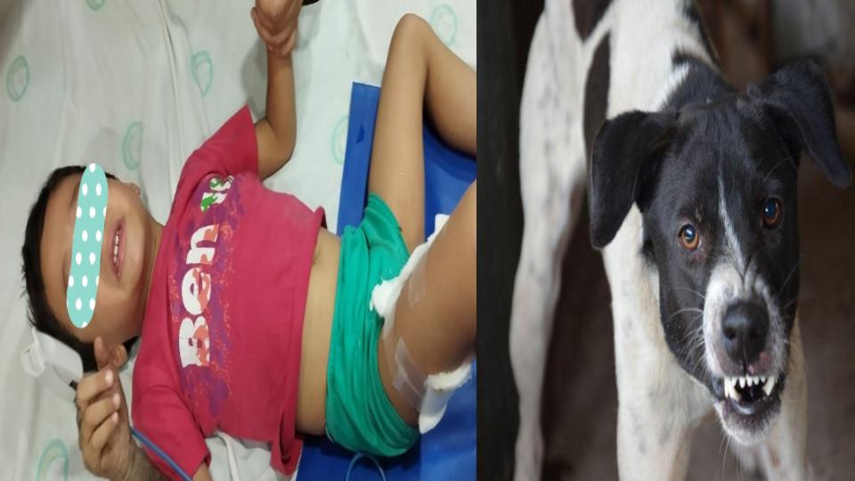 straydogattacks4yroldboyinmehdipatnamhyderabad