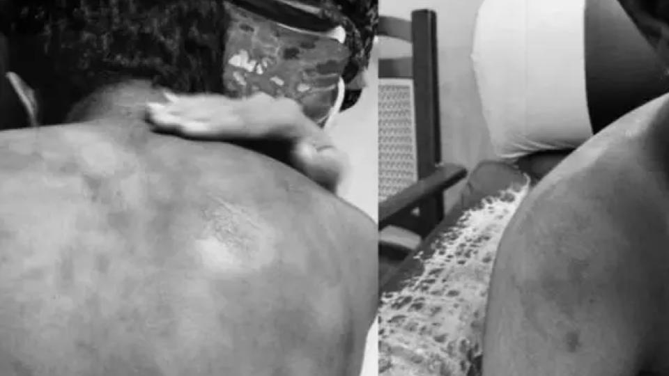 Student Allegedly Assaulted by Classmates at Dammaigudem Hostel 
