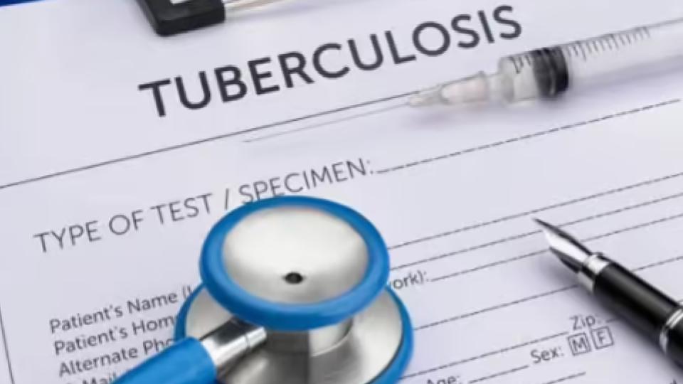 Telangana deploys AI handheld X-ray devices to improve TB diagnosis