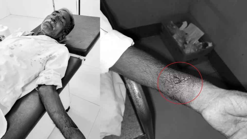 straydogsattackelderlypersoninbhupalpally