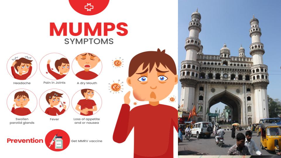 expertflagsrisingmumpscasesinhyderabad’soldcity