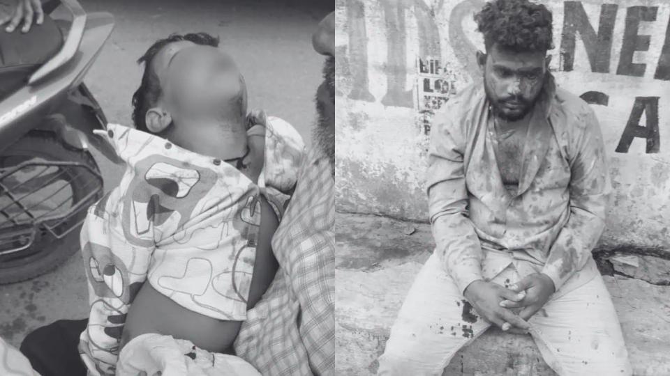 Minor boy dies days after father’s attack in Gudimalkapur