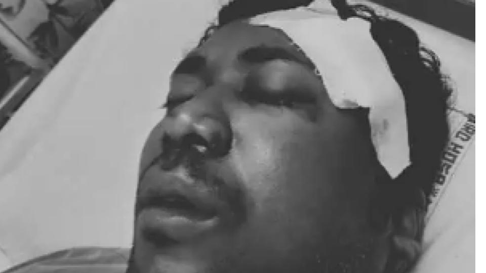 Delivery boy critical after accident in Hyderabad