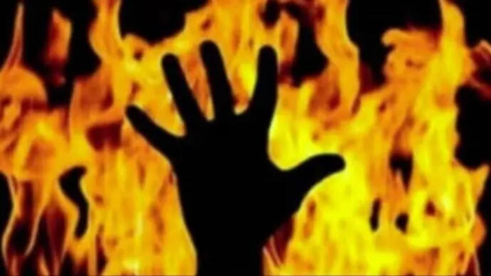 Woman with found serious burn injuries near Sadasivapet