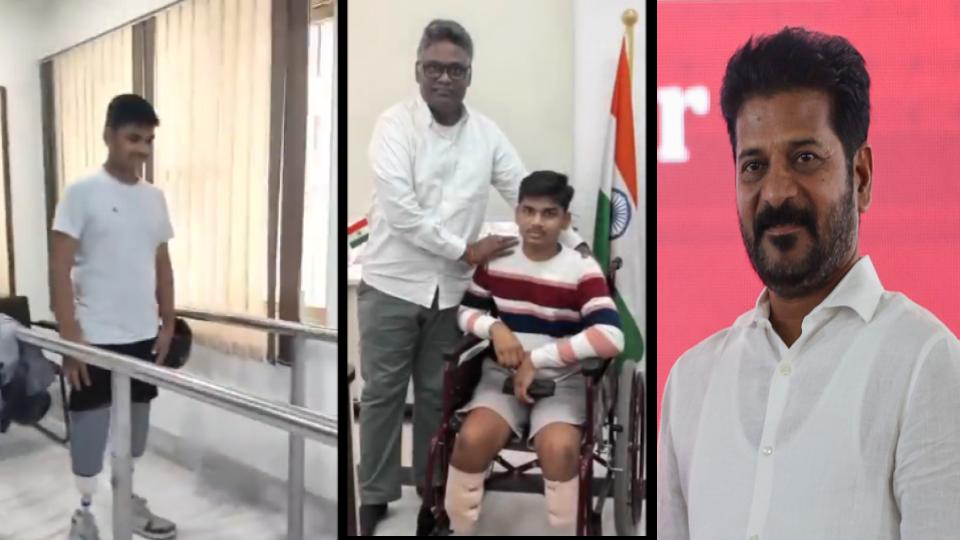 Rahui loses legs in train attack, walks again with CM Revanth help