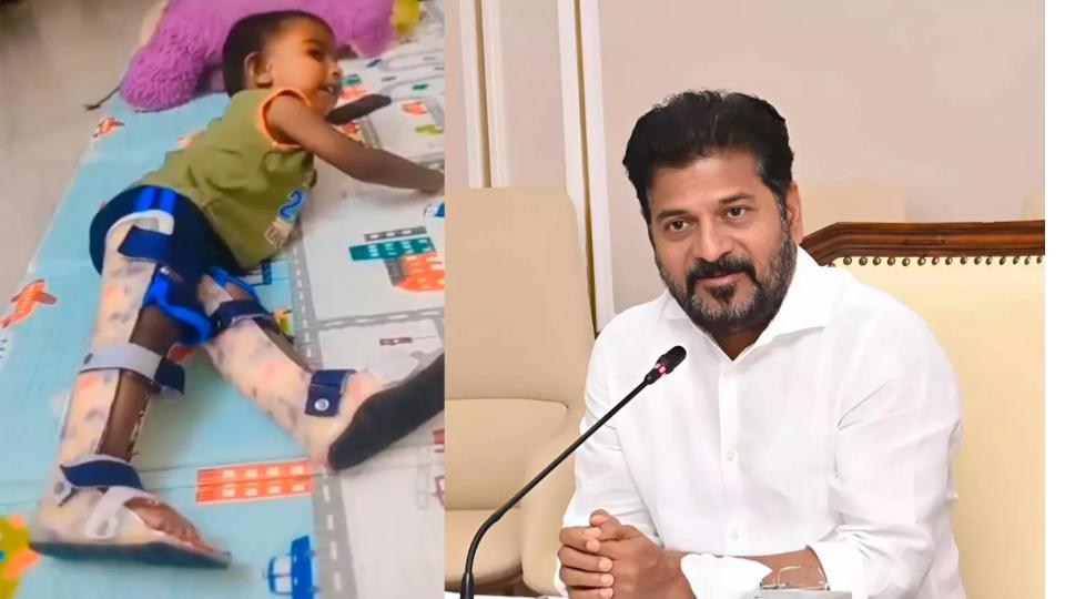 CM Revanth Sanctions Rs 75 Lakhs From CMRF For Baby