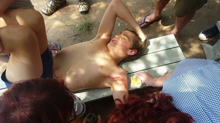 cheetahattacksnzboyinsouthafrica
