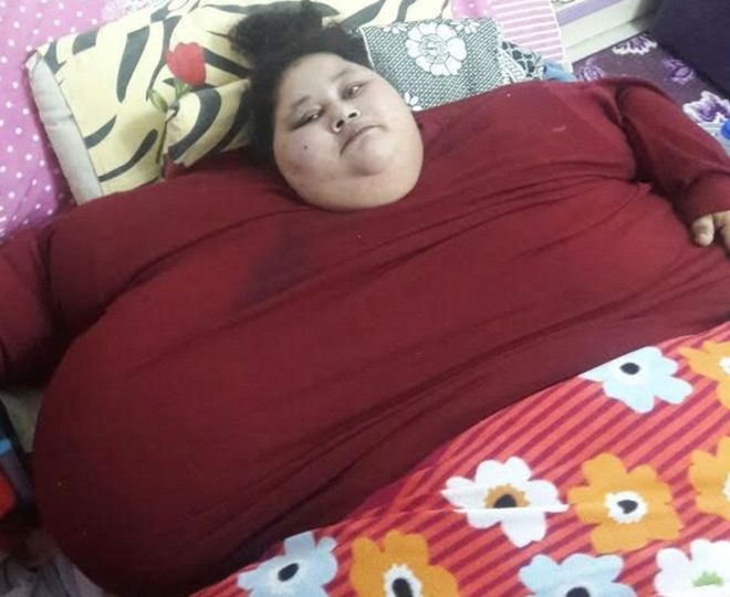 indiadoctortooperateon500kgegyptianwoman