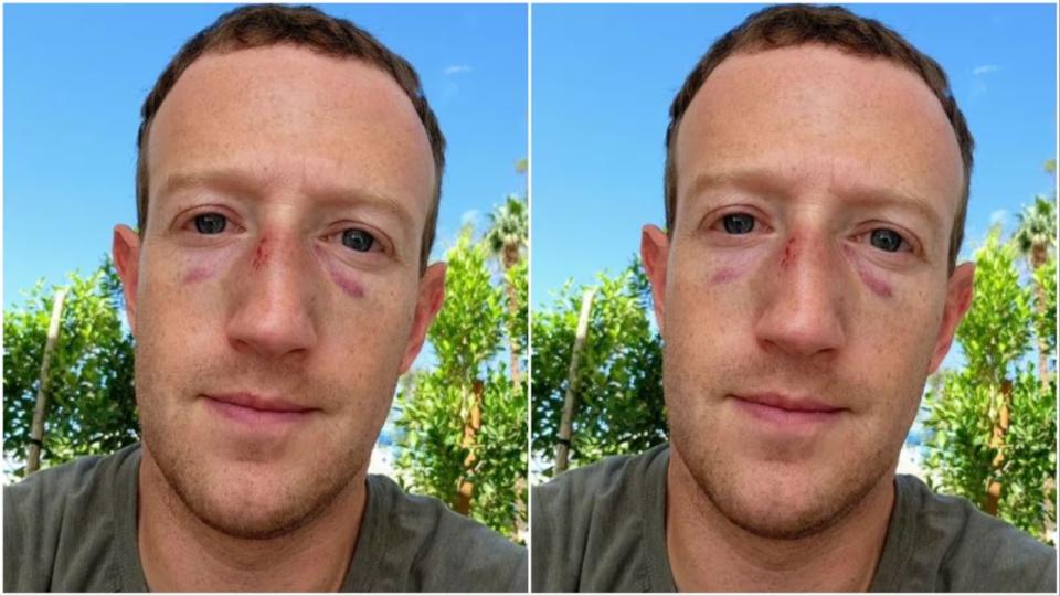 Zuckerberg shares selfie with swelling and bruises on his face