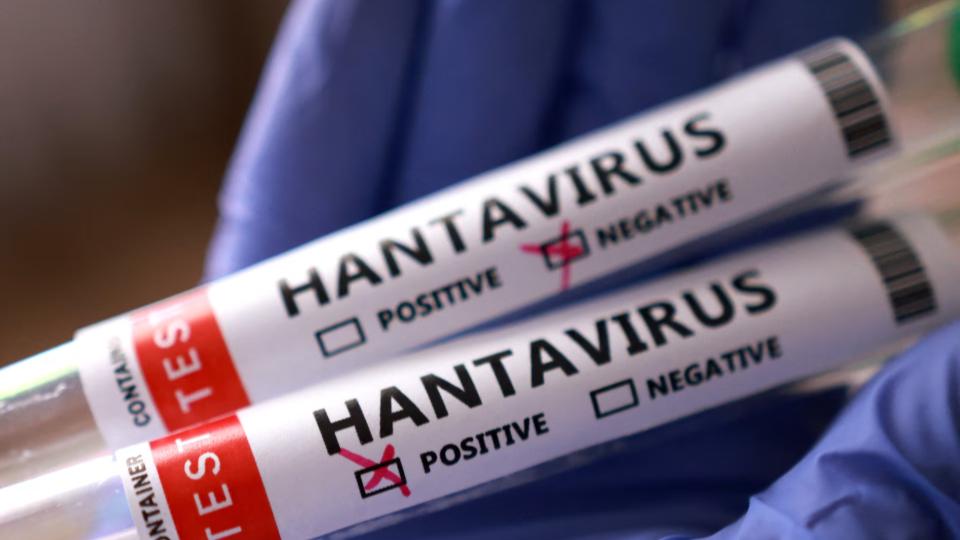 unitedstatespassengertestedpositiveforhantavirus