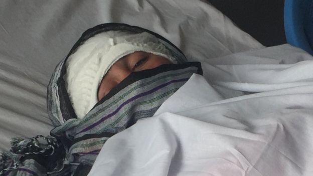 afghanwomanmutilatedbyhusbandseekstreatmentabroad