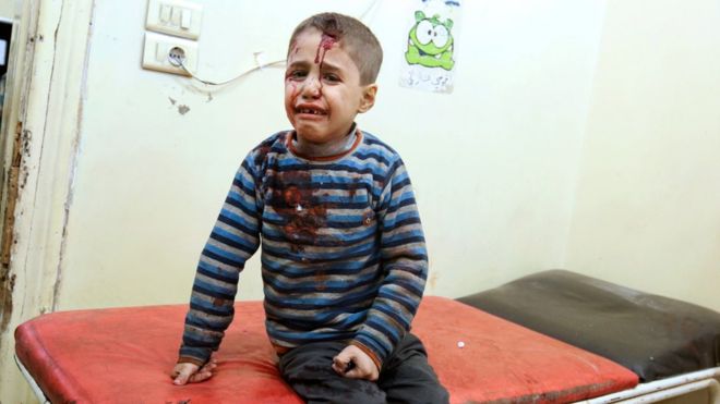 syriaconflict:alepposuffersintensebombardment