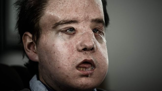 frenchmangetsthirdfaceinnewtransplant