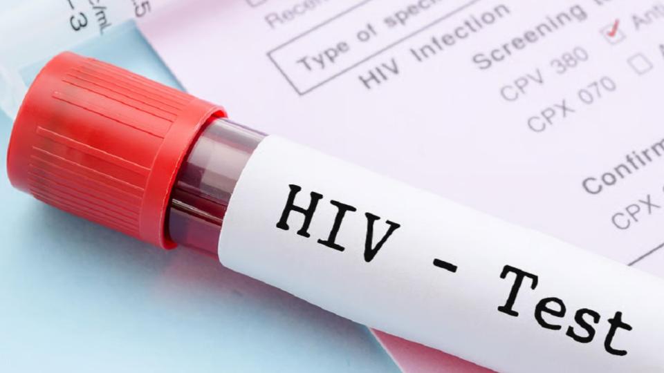 MMS HIV Infections on Rise in Karnataka, 417 Cases Reported