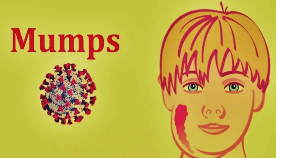 tamilnaduissueshighalertasmumpsspreadamongschoolchildren