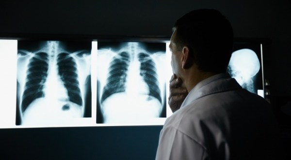 radiologiststogoonstrikefromsep1