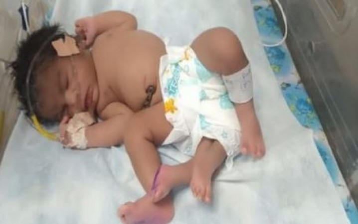 womangivesbirthtobabygirlwith‘four’legsingwalior