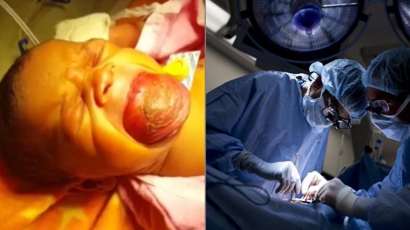 girlbornwithlargetonguesmilesagainaftersurgery