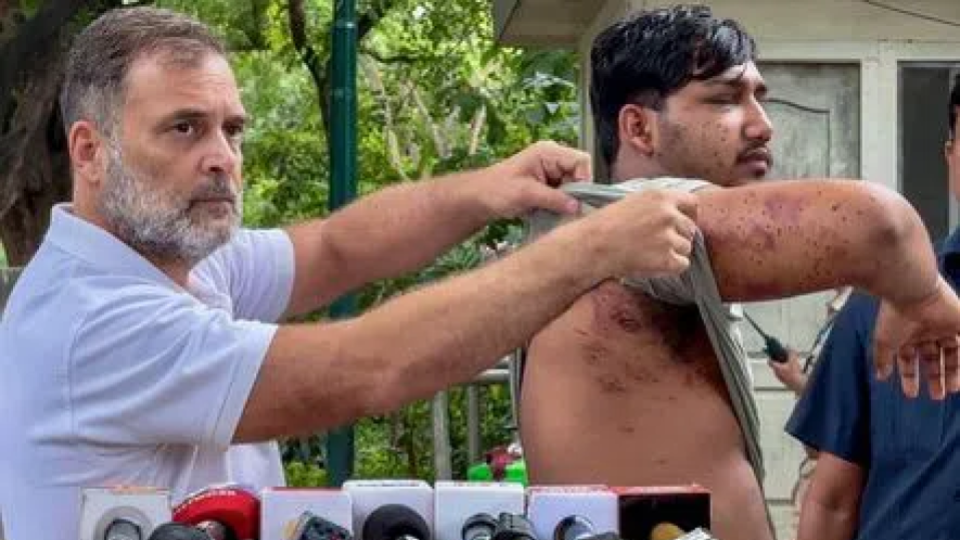 Petition in Supreme Court seeks ban on pellet guns
