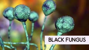 over300casesofblackfungusreportedinkarnataka