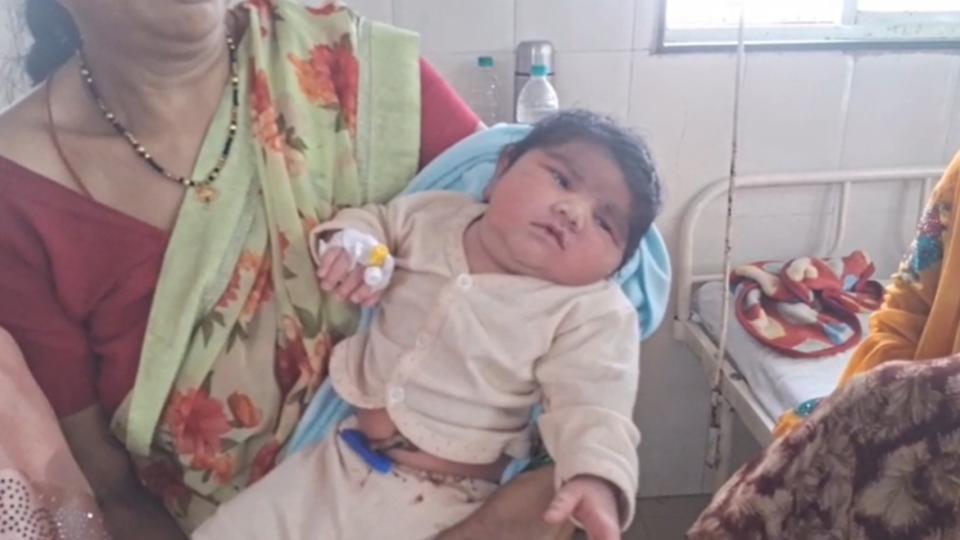 5.2kg Baby Born at Hospital in Jabalpur, Madhya Pradesh