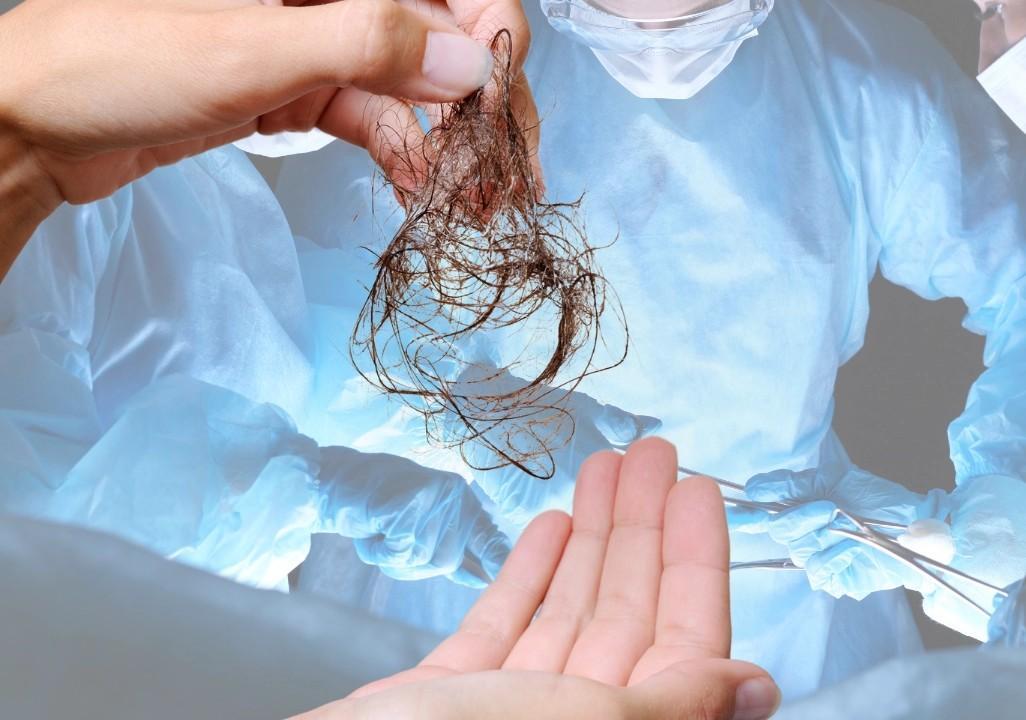 Half kg hairball removed from 10-yr-old girl’s stomach in Maharashtra