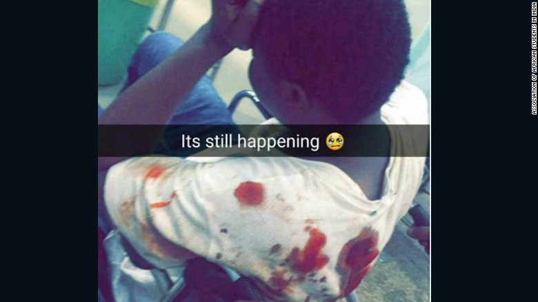 africanstudentshospitalizedinrovingmobattacksinindia