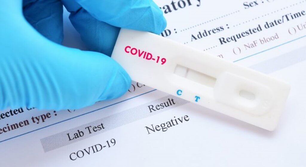 testingcovid19tooearlyproducesfalsenegativeresults:johnshopkinsstudy