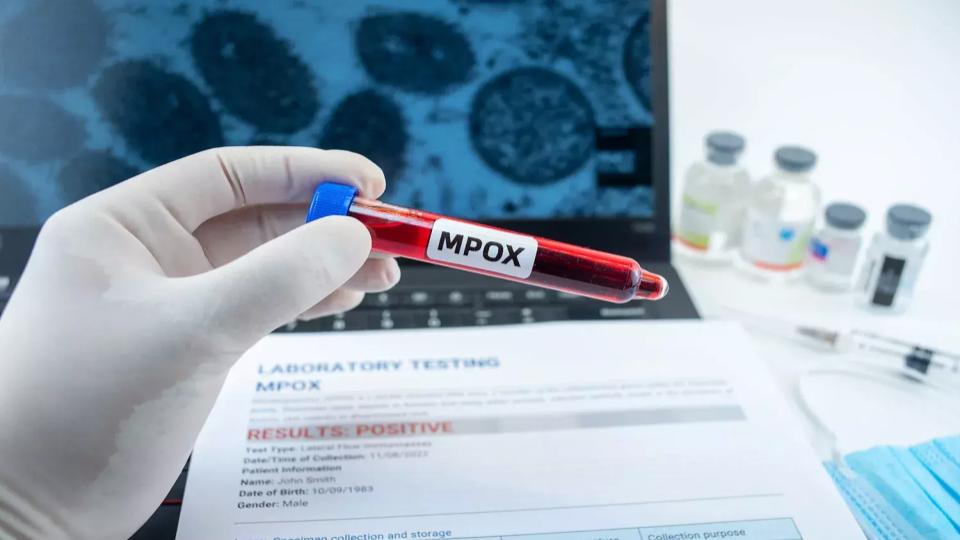 centreadvisesscreeningtestingandisolationforsuspectedmpoxcases