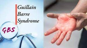 guillain–barresyndrome:twosuccumbinandhrain10days
