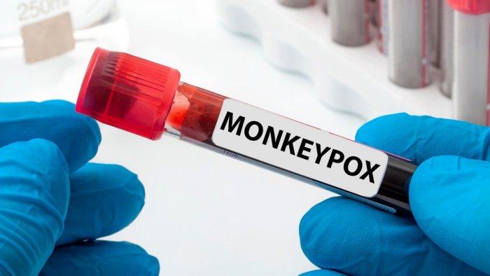 monkeypoxdiagnostictestingintroducedatnivinalappuzhakerala