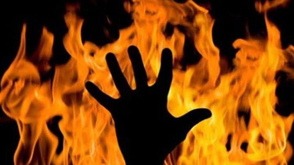 Man sets wife ablaze over nightdress dispute in Karnataka