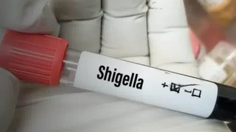 Kerala reports 146 Shigella cases this year, 70 recorded in June