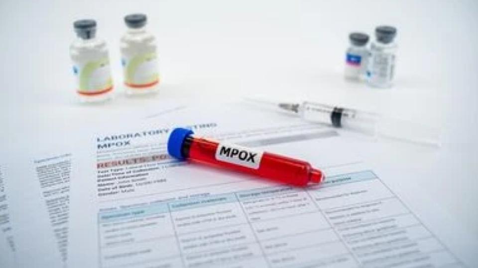 Kerala mpox cases linked mainly to UAE travel