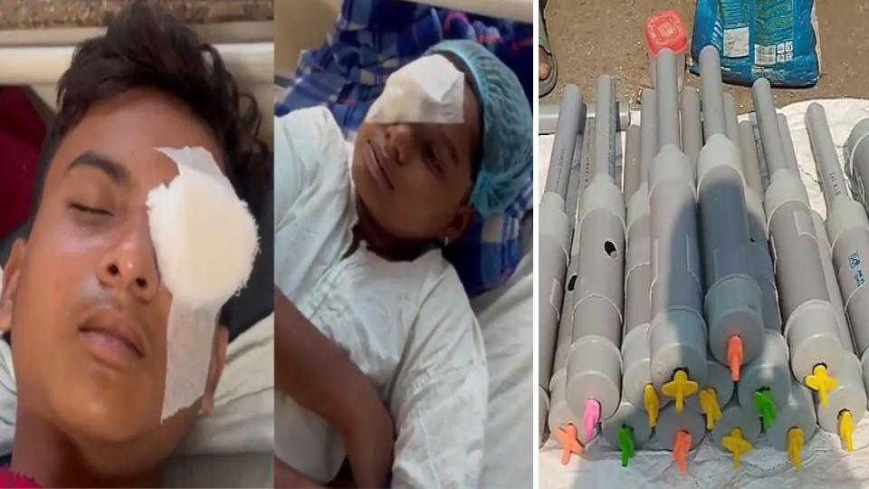 over60injuredseveralchildrenloseeyesightinbhopalcarbidegun