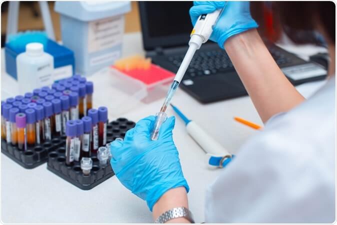 telanganagovtfixespriceofcovid19testsandtreatmentinprivatelabsandcorporatehospitals