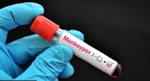 healthministryreleasesdosanddon’tstopreventcontractingmonkeypox