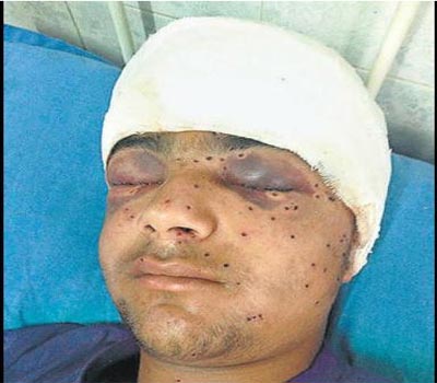 policepelletsblindkashmirteen